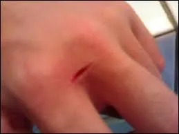 En premier lieu, en cas de coupure, il est recommand .....