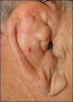 Entendre mal ou pas bien du tout ...