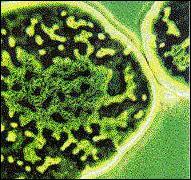 Les organes sont-ils tous attaqus par les microbes ? .