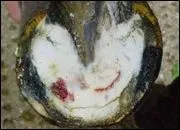 Comment s'appelle cette blessure ?