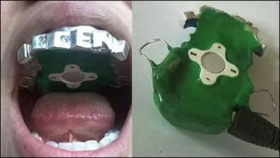 Qu'est ce que c'est ?