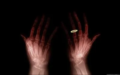 Celle-ci par contre a une ...