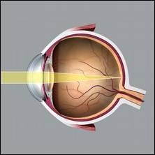 Un il normal, c'est--dire un il qui ne prsente aucun dfaut de vision, est un il...