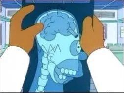 Quel objet s'est-il coinc dans son cerveau lorsqu'il tait petit ?