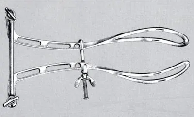 Dans l'histoire de l'obsttrique, la premire paire de  forceps  apparat ds le :