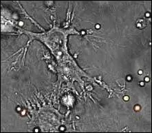 A quelle cellules correspond l'image ci-jointe ?