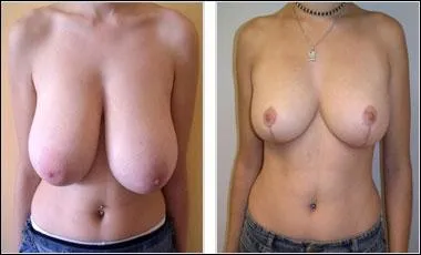 Professeur Mamilla vient de pratiquer une intervention esthétique plutôt réussie.