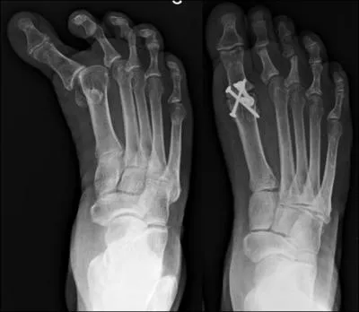 Quel synonyme proposez-vous pour l'adjectif "réductible" ?