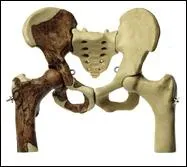 Quels os appartiennent au bassin ?