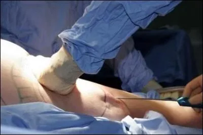 Parfois utile pour la disgrasse ou disgrce, une ...