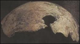 Il reste dans les archives du KGB un fragment de crâne présenté officiellement comme celui d'Hitler. Quelles ont été les conclusions du scientifique américain chargé de l'analyser en 2009 ?