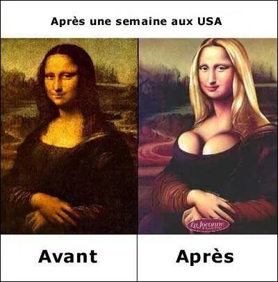 Le nom de la prothse qui permet par chirurgie d'augmenter le volume d'une poitrine, et qui est  l'origine de nombreuses dconvenues.