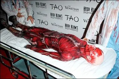 Qui est arriv(e) ainsi en corch(e) sur une civire pousse par deux toubibs ensanglants ?