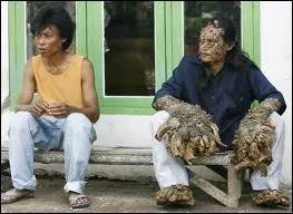 Sur ses mains ce sont des ...