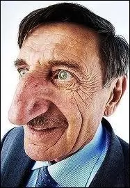 Quelle est la taille du plus grand nez du monde chez l'homme ?