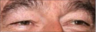 Ces yeux sont ceux de :