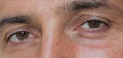 Ces yeux sont ceux de :