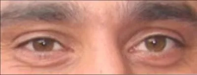 Ces yeux sont ceux de :