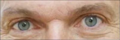 Ces yeux sont ceux de :