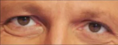 Ces yeux sont ceux de :