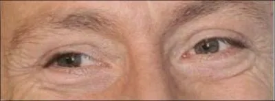 Ces yeux sont ceux de :