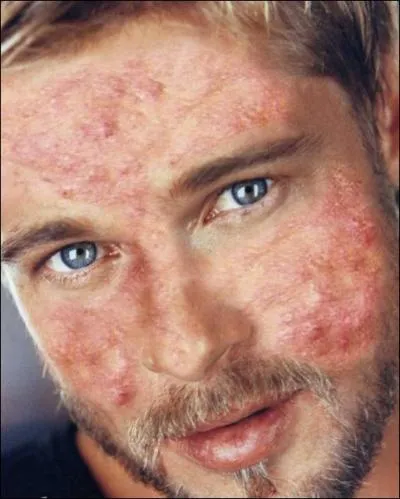 Beau de loin mais loin d'tre beau ! Qui est-ce ?