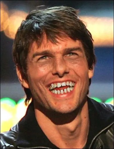 Frre de Rain Man, il a pris une pluie acide, qui est-ce ?