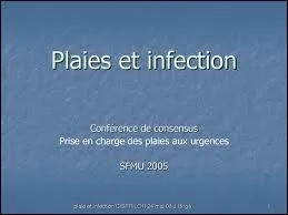 Voici ce qu'il se passe en cas d'infection : -A : dilatation du capillaire -B : arrive des globules blancs -C : prolifration des bactries-D : phagocytose. Cette phrase est fausse, remettez-y de l'ordre.
