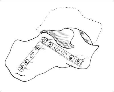 Un  ...   pour perceuse.