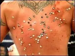 Randy Orton a le dos plein de :