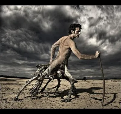 En Roumanie, cet homme, Vassilius Vousaeus, est une clbrit, il a survcu  sa malformation !