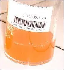 En cas d'urine trouble, cela tmoigne-t-il toujours d'une infection urinaire ? 