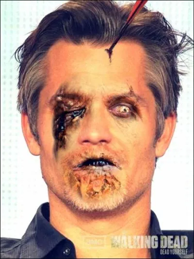 C'est durant le tournage de  Deadwood  que la crature vous a tratreusement attaqu, vous mordant  l'paule !