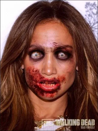 Quel manque de chance, se faire mordre au mois de juin 2012, alors que vous commencez la tourne de  Dance Again World Tour  !