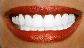 quel animal a le plus de dents
