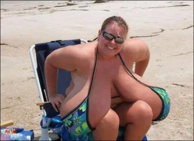 Non, ce n'est pas une pub pour des sacoches de voyage, ce sont bien les attributs de cette dame, excessivement gte par la nature !