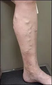 Le mot commence par : A ...