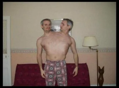 Sont-ils siamois ou c'est un montage ?