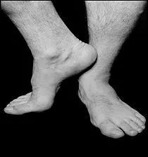  qui sont ces pieds dont le  propritaire  adore Bernie, chausse du 48 et pse 120 kilos ?