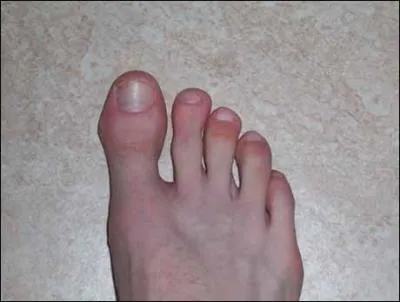 Quel est son pied fort ?