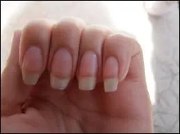 Comment s'appelle le blanc de l'ongle ?