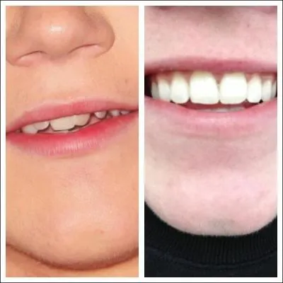  qui appartient ce joli sourire ?