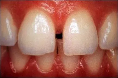 Chanteuse et actrice franaise devenue clbre  14 ans, elle s'appelle :