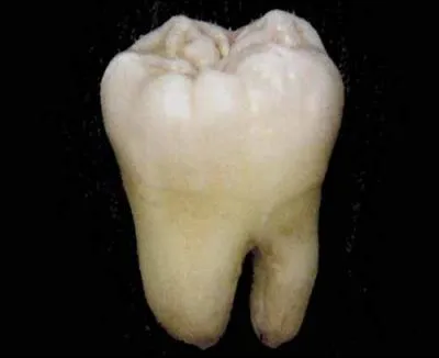 Que collectionne un dentiscalpiste ?