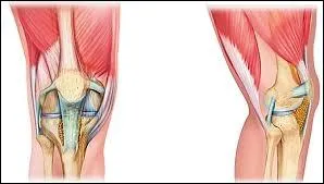 Retour dans les services d'orthopdie et de rhumatologie o les mdecins peuvent pratiquer le test de Lachman au niveau du genou. Quelle partie de cette articulation est alors teste ?