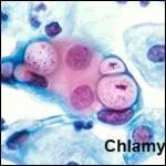 Le mot  vnrien  correspond  diverses maladies contagieuses qui ont pour origine les relations sexuelles. Quelle figure mythologique est  l'origine de ce mot ?