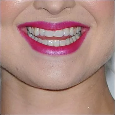 Voici la bouche d'une clbre chanteuse, actrice et animatrice tl. Elle s'appelle :