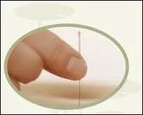 En quelle anne a eu lieu la rforme de Pkin sur l'acupuncture ?