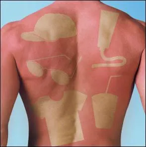 Quelles sont les heures les plus chaudes d'une journe o il faut viter de s'y exposer ?