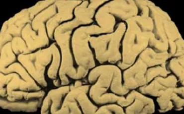Quiz Cerveau